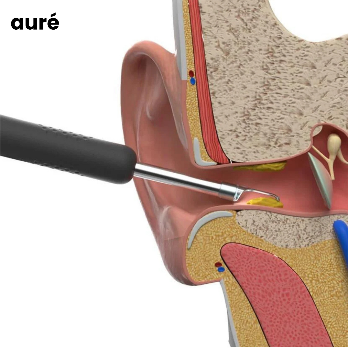 Aure® Visio Ohr-Reinigungs Pro 3