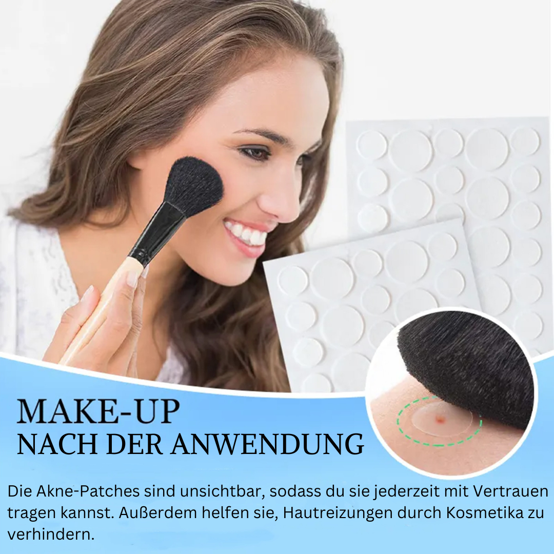 Glovéa Acne Patches