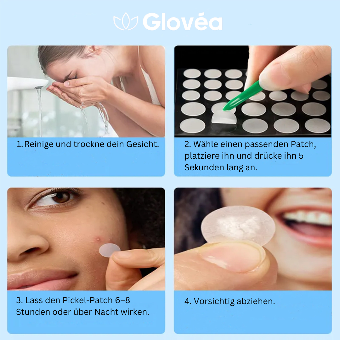 Glovéa Acne Patches